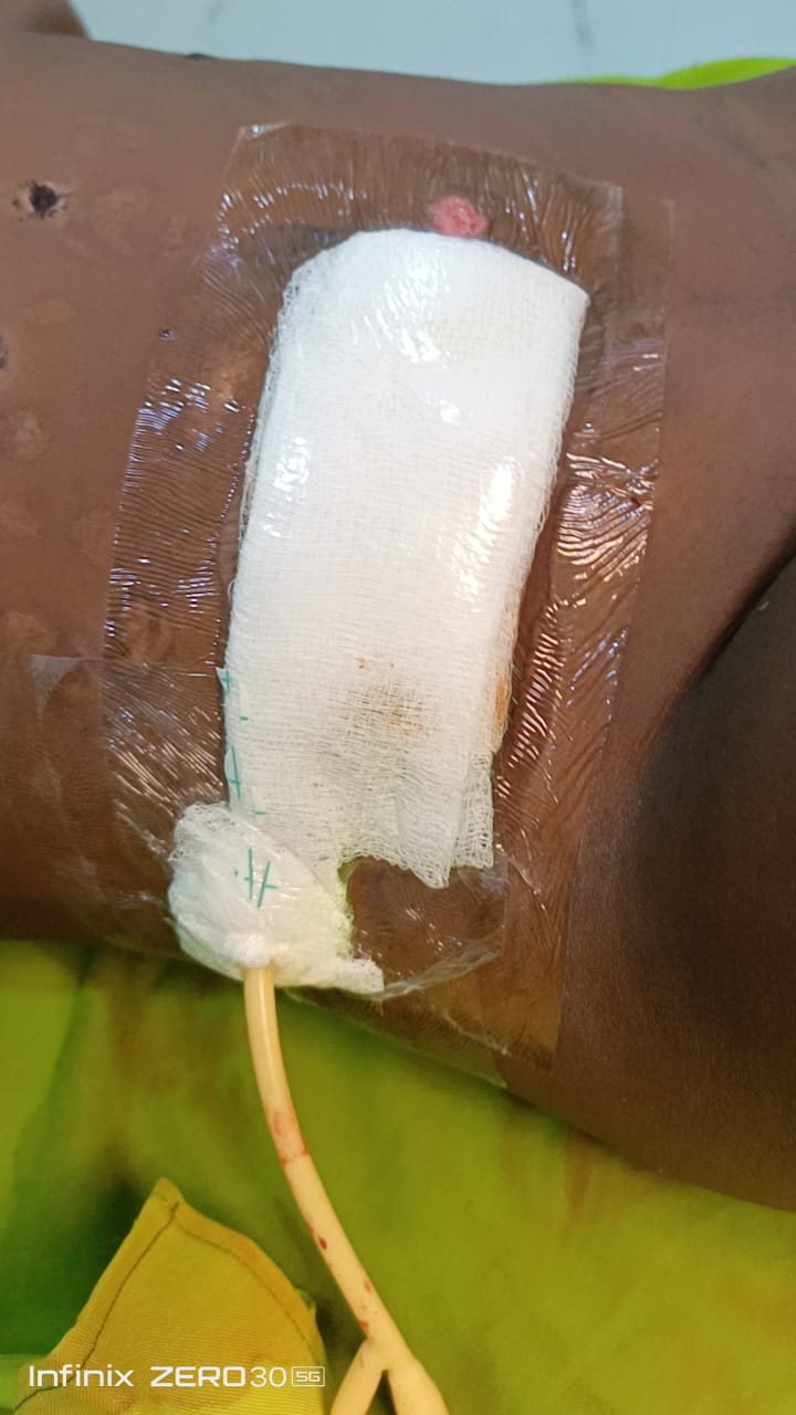 Seldom Plaster Large w/p - Image 2