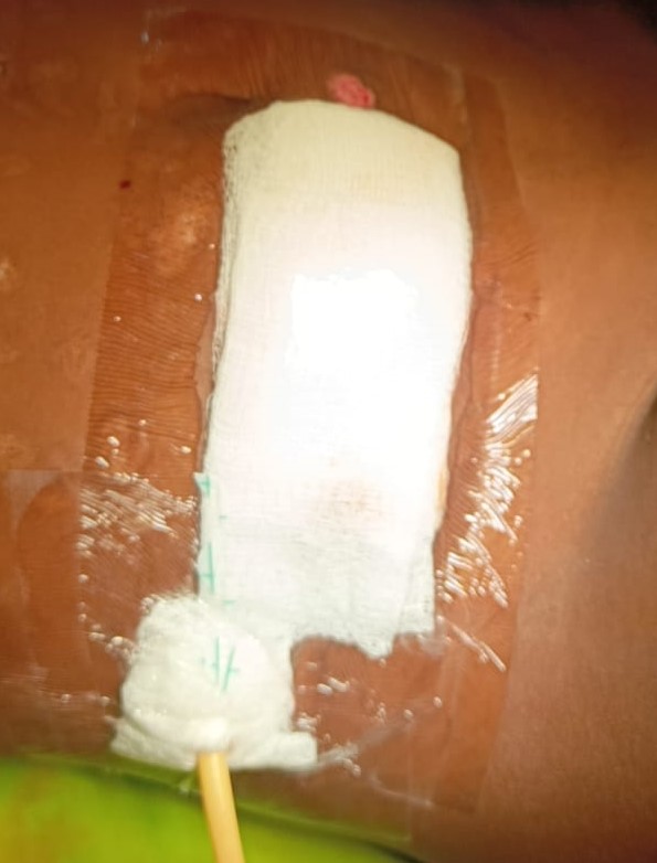 Seldom Plaster Large w/p - Image 7