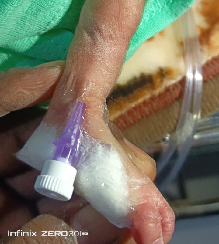Seldom Cannula Plaster w/p - Image 3