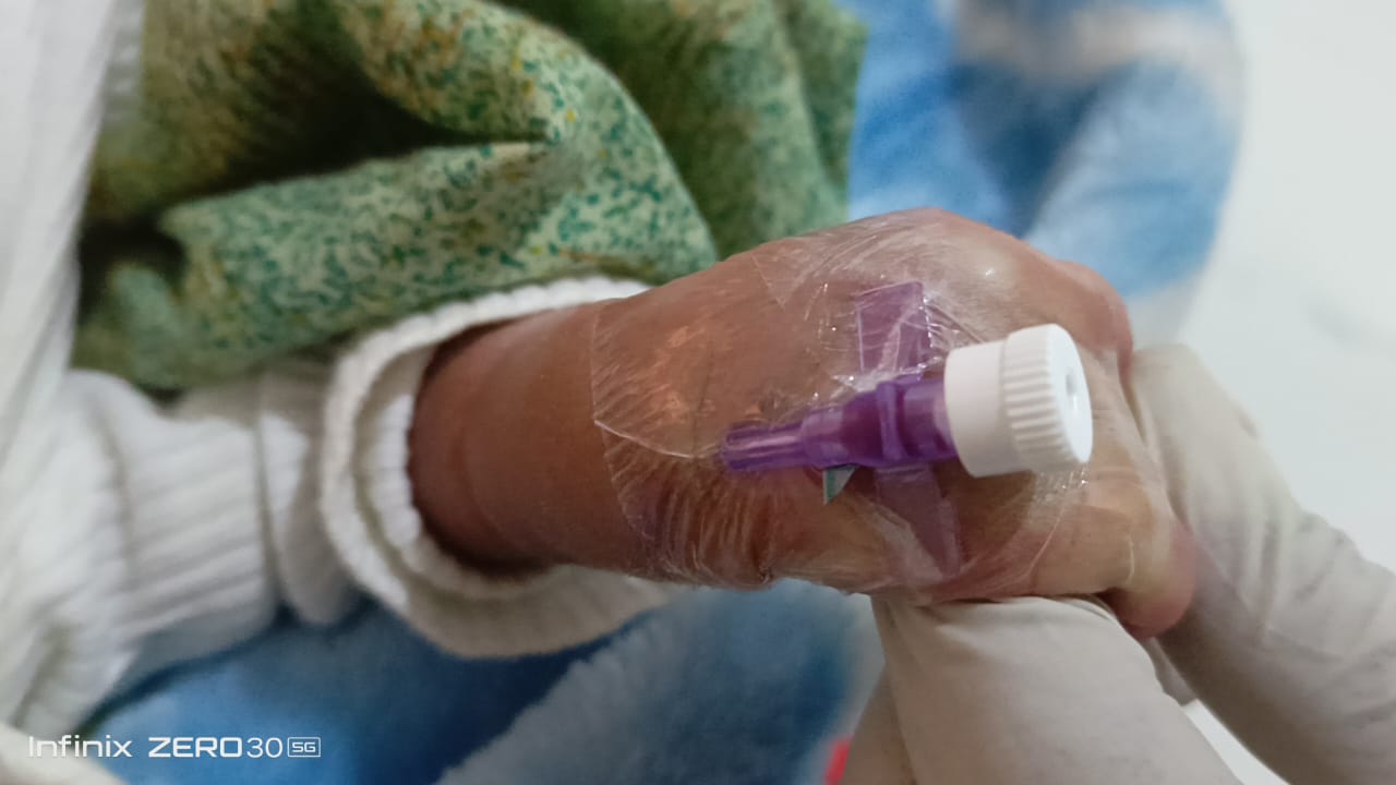 Seldom Cannula Plaster w/p - Image 5