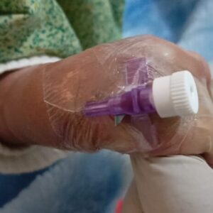 Seldom Cannula Plaster w/p