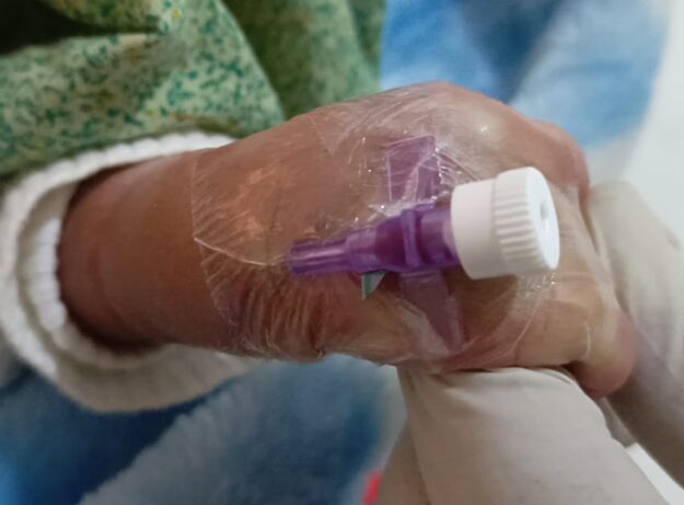 Seldom Cannula Plaster w/p