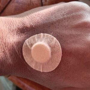 Hemostatic Patch