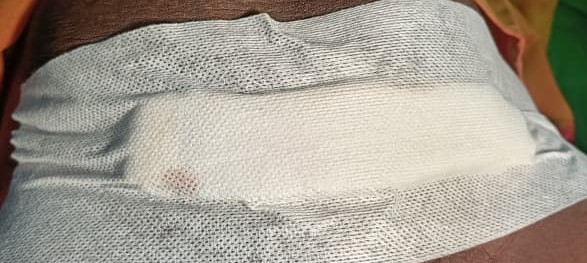 Seldom Abdomen Plaster large n/m