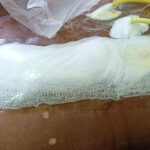 Seldom Plaster Large w/p