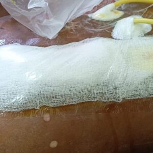 Seldom Plaster Large w/p