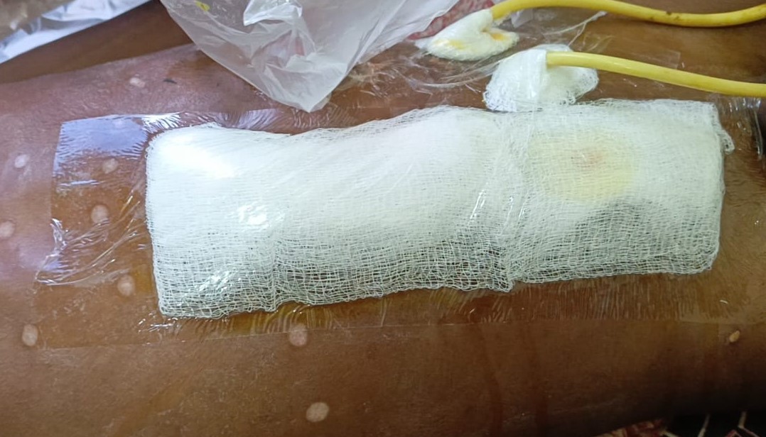 Seldom Plaster Large w/p